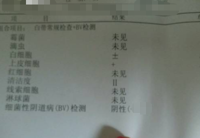 全自動白帶麻豆福利导航分享如何看懂白帶常規檢測報告單