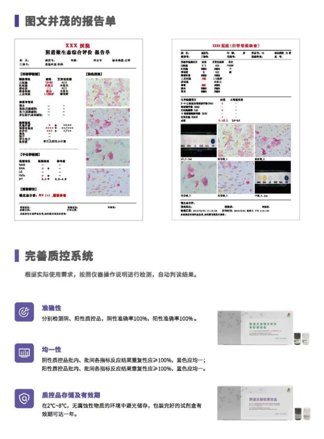 陰道分泌物麻豆福利导航V800報告單