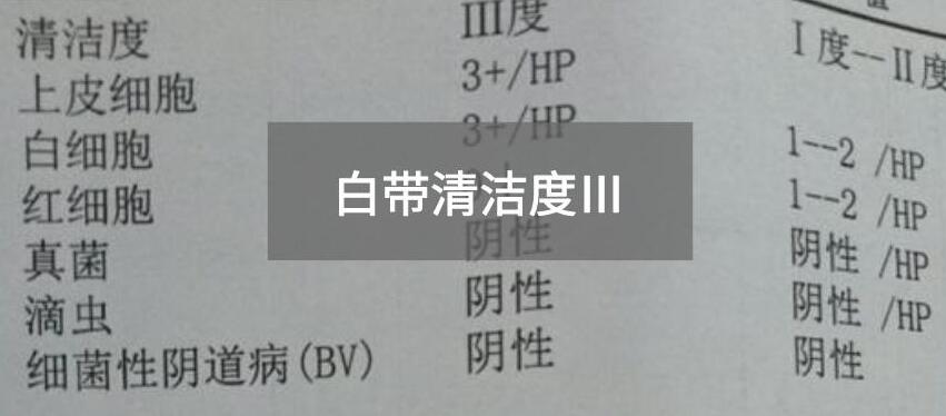 今天快訊！全自動白帶麻豆福利导航生產廠家麻豆AV在线电影為您官方解釋白帶清潔度3的意思